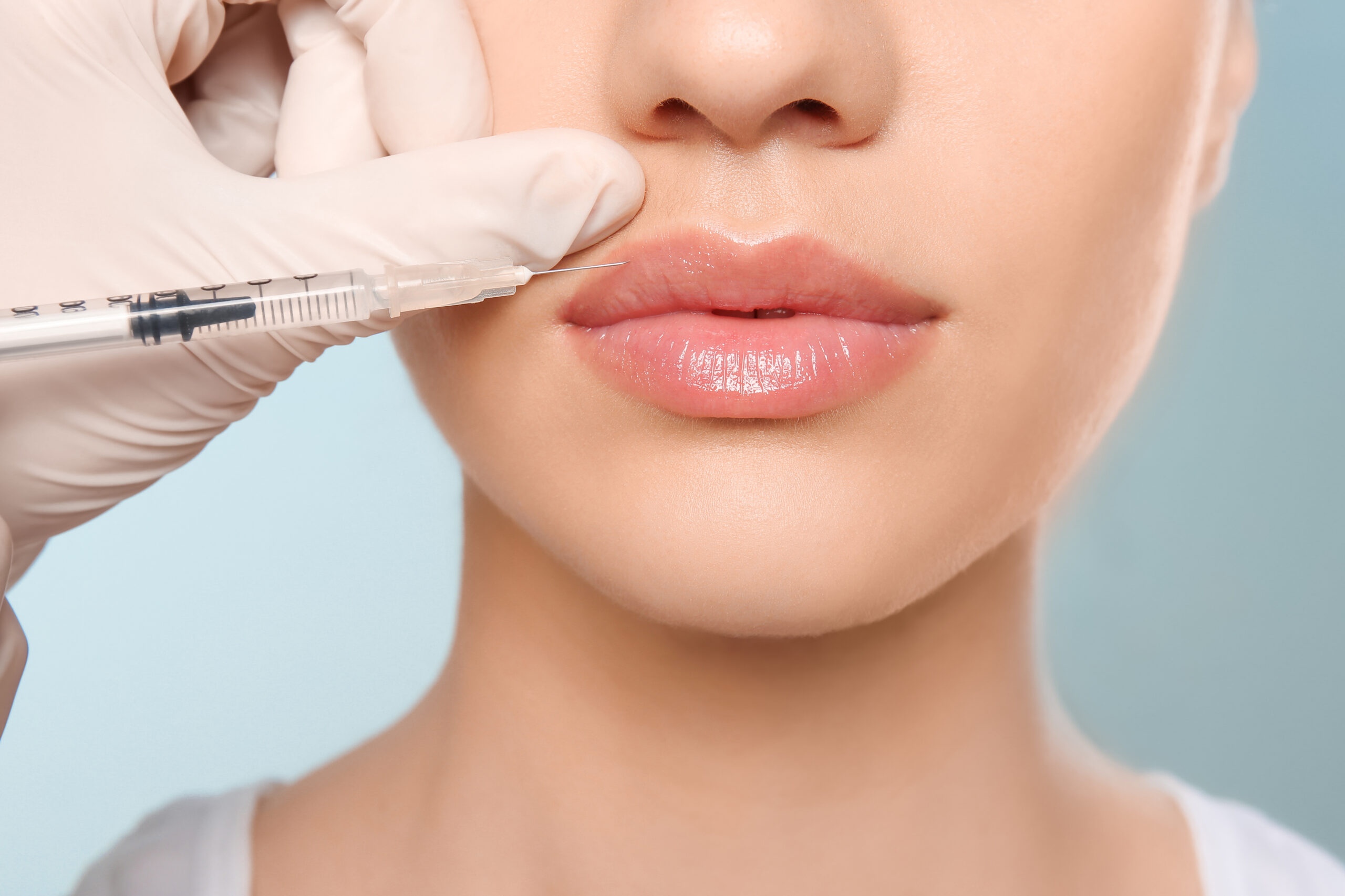 Lip Fillers
