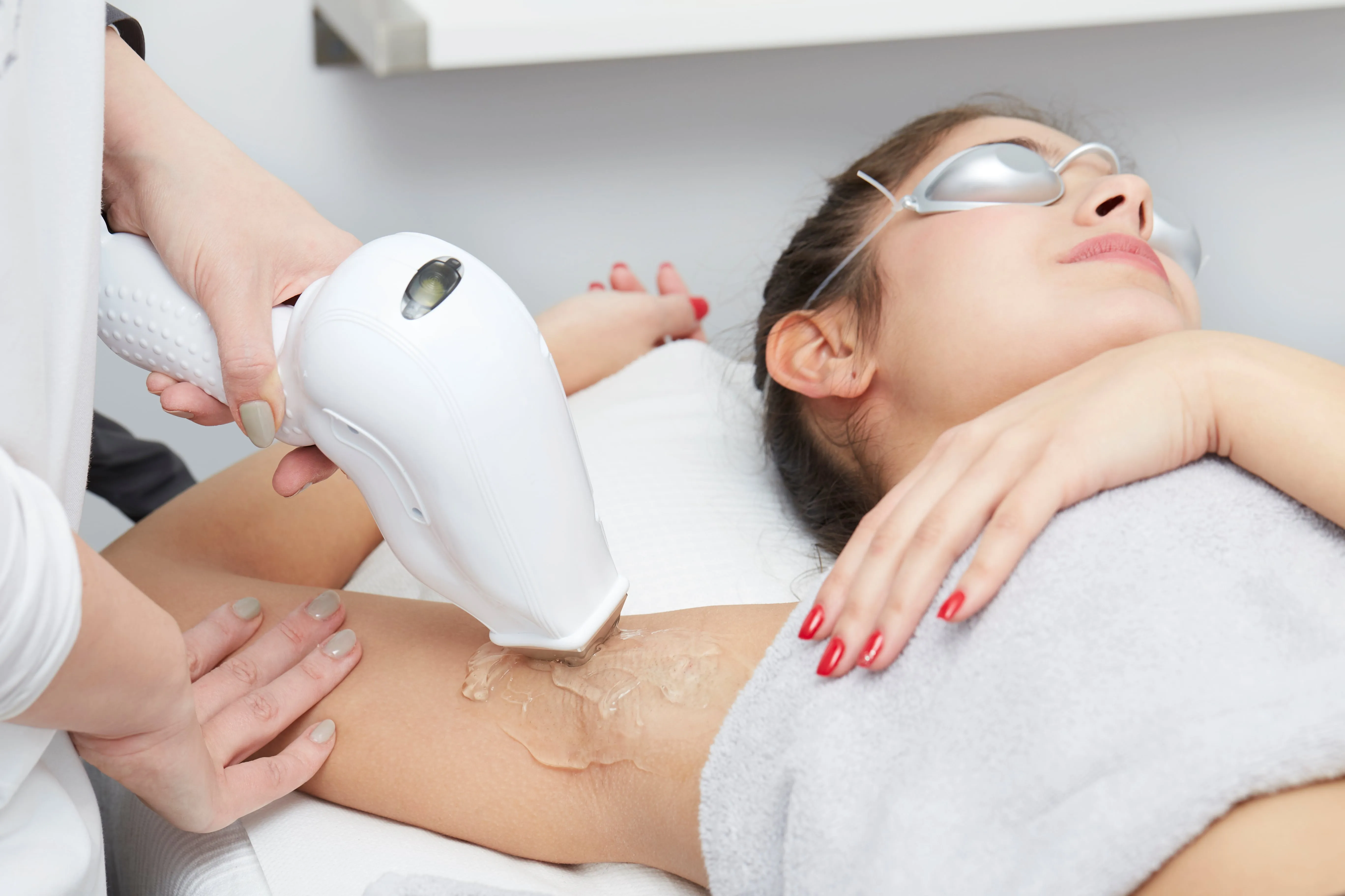 laser-hair-removal Peel Treatment