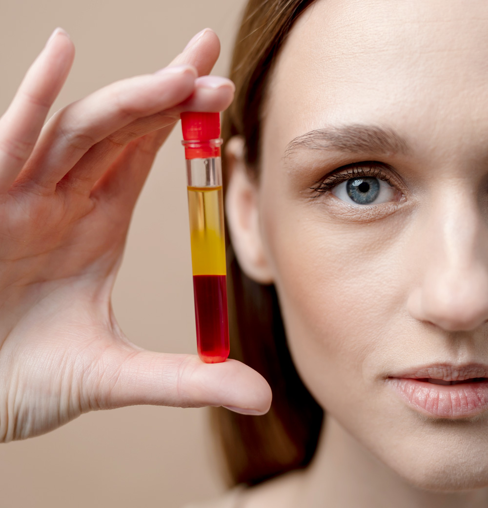 Platelet-Rich Plasma (PRP)