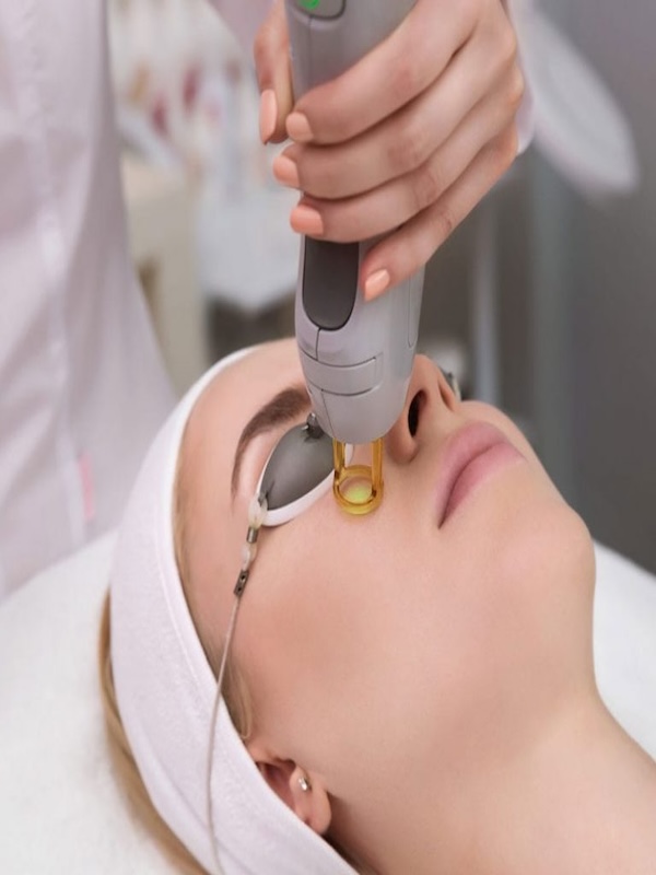 Fractional Laser Resurfacing